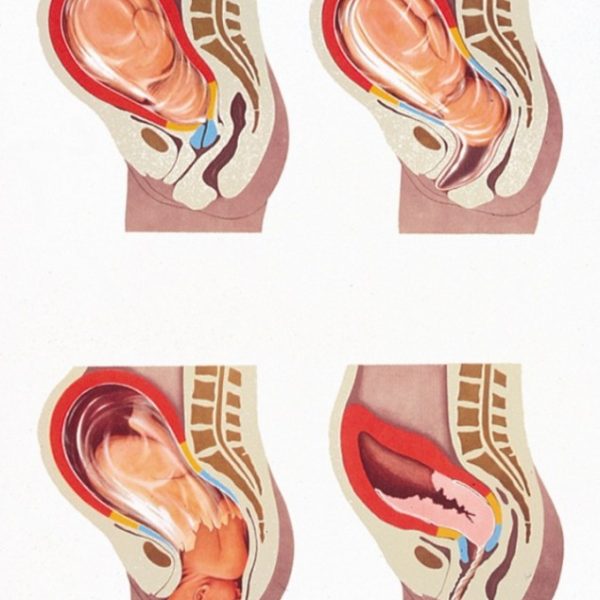 The Female Pelvic Organs Chart