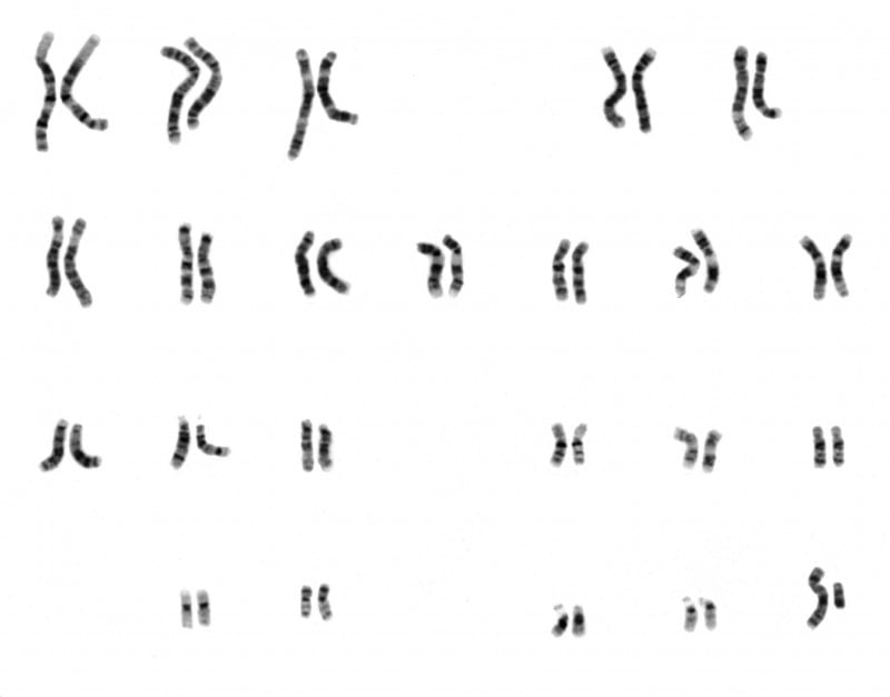 Human Chromosomes - Διερευνητική Μάθηση