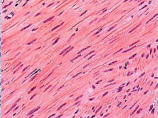 6183_O Smooth muscle , human