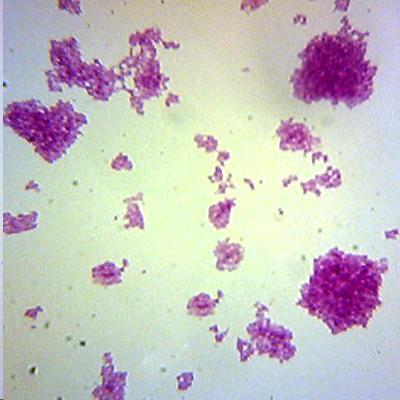 Staphylococcus epidermidis - Διερευνητική Μάθηση