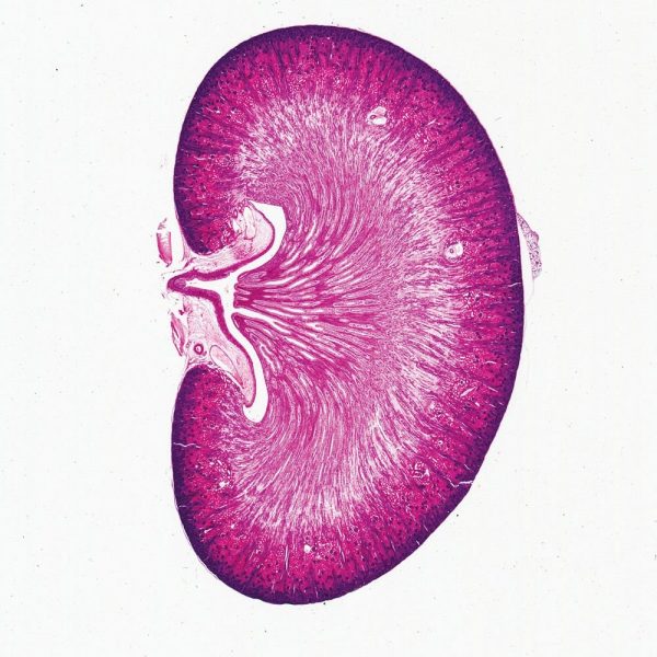 Νεφρός Γάτας (Παρασκεύασμα Μικροσκοπίου)