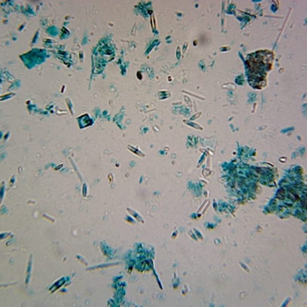 Diatoms (Microscope slide)