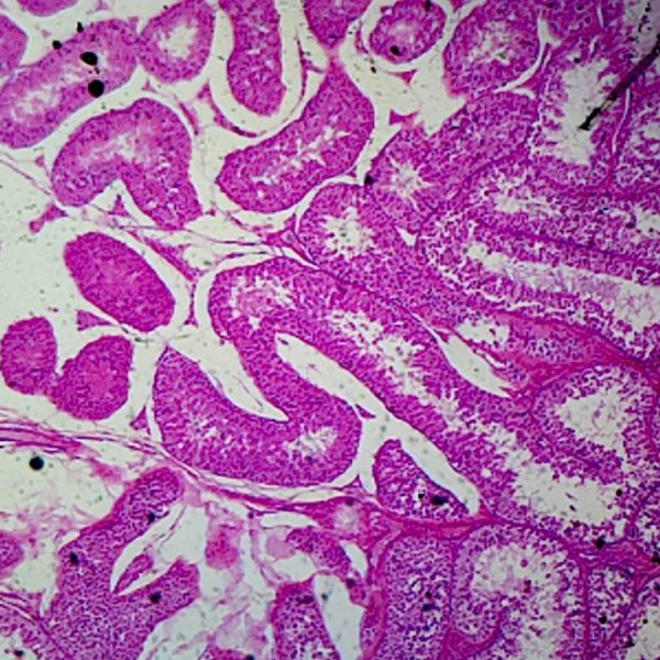 Testis of rabbit (Παρασκεύασμα Μικροσκοπίου)
