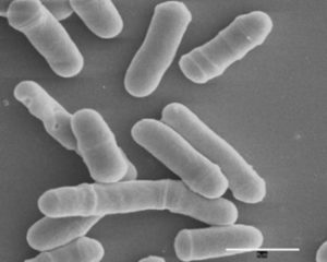 Μικροβιολογικές Αναλύσεις στον Οίνο - Ζύμες - Γαλακτικά βακτήρια