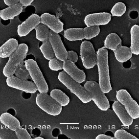 Μικροβιολογικές Αναλύσεις στον Οίνο - Ζύμες - Γαλακτικά βακτήρια
