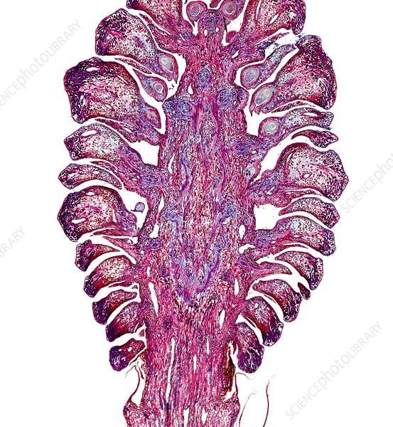 Pinus female (Παρασκεύασμα Μικροσκοπίου)